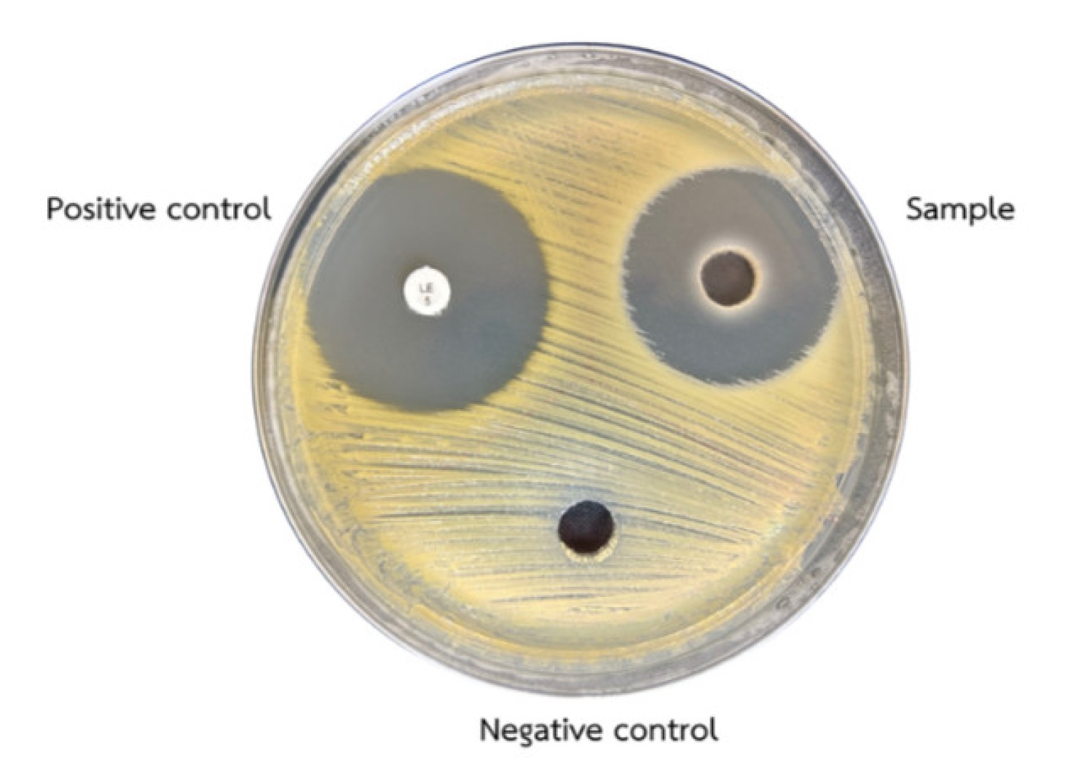การทดสอบ Agar diffusion method (Disk diffusion method และ Agar well diffusion method)